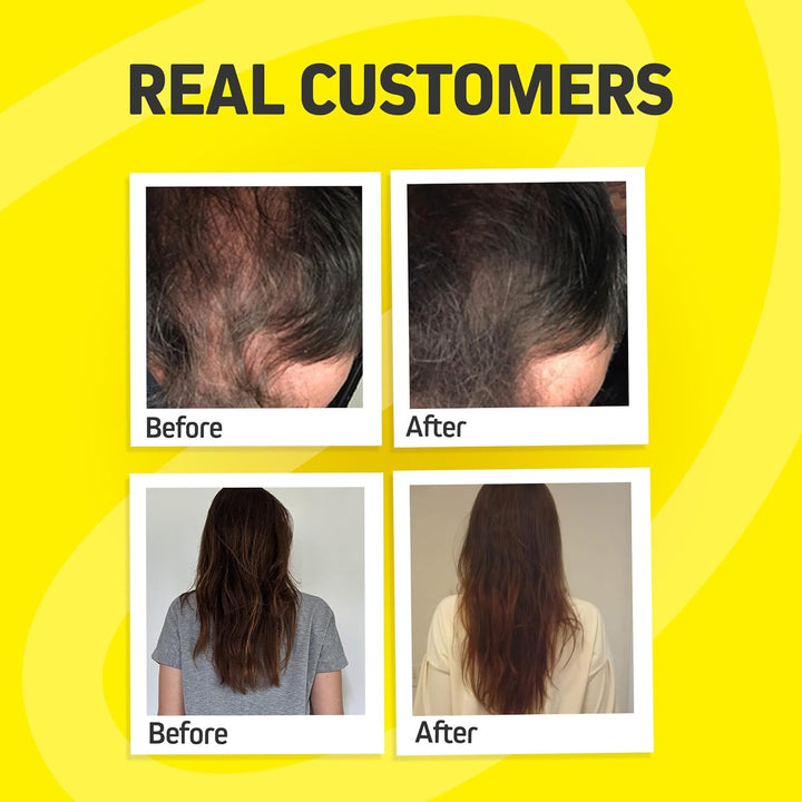 FOLI-TONIC (60 Capsules)